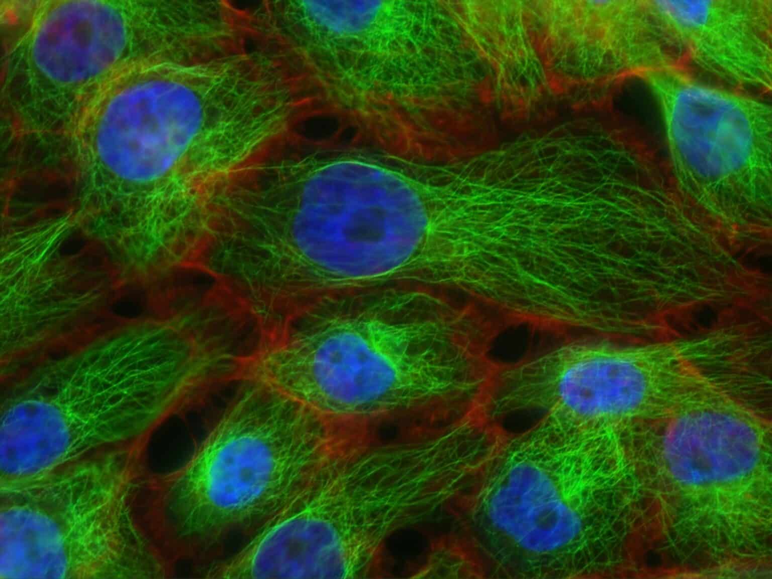Cells under a microscope